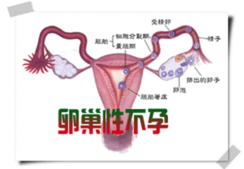155005vjv2jv6ejjb60pgt.png