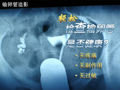 输卵管造影.jpg