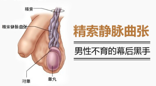 精曲原因.png