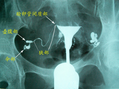 6-120G1152SY30.jpg
