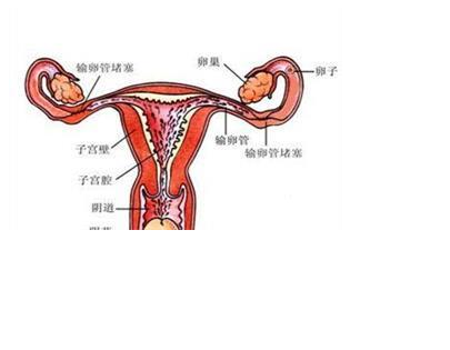 宫腔粘连会引起哪些并发症的出现