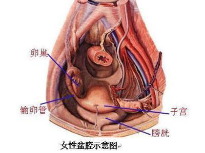 盆腔腹膜炎图片说明