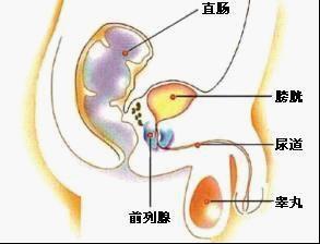 前列腺囊肿手术后注意事项