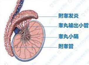 睾丸癌的病理是什么