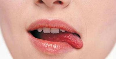 请问得了舌癌患者的寿命有多久呢