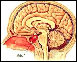 垂体瘤的影响有哪些