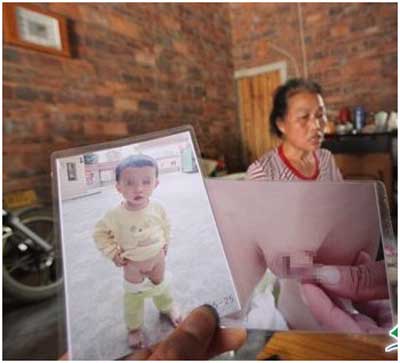 漳州一两岁男童尿床被幼儿园园长粗暴拽伤生殖器
