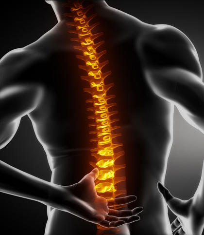 与男性相比,发生脊椎侧弯的人群是男性的3倍,脊椎侧弯的特别