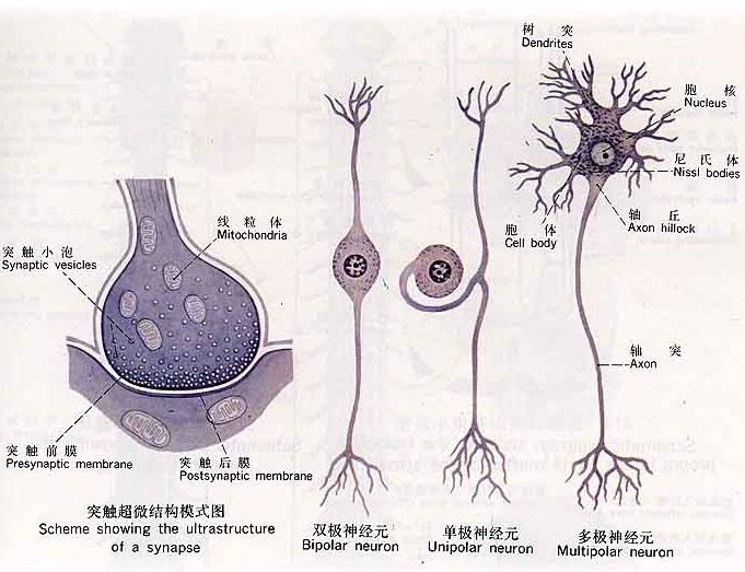 变性限于脊髓前角α运动神经元,其发病机理为脊髓前角神经细胞及