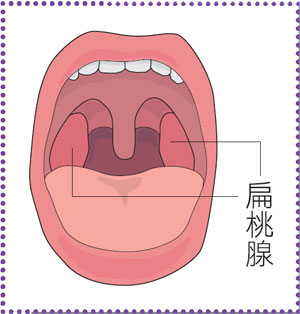 扁桃体炎影响怀孕吗-1 - 飞华健康网