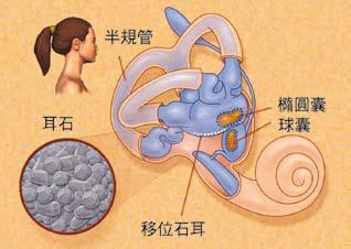 耳石症的症状表现主要会是什么呢