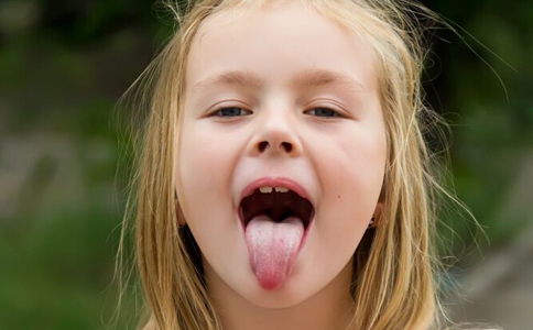 儿童患上地图舌严重吗