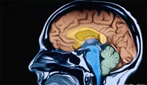 浅析几种常见的脑梗塞的检查方法