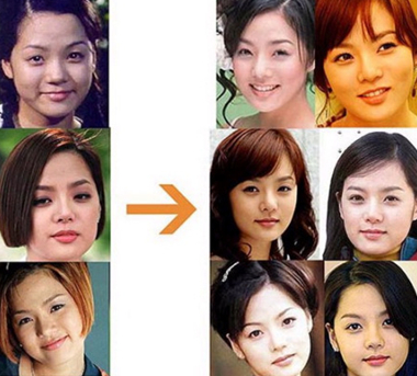 4位韩国女星整容前后惊悚对比照