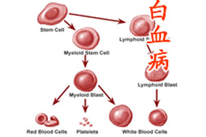 > 内科 > 血液科 > 白血病 > 护理  多食高蛋白:白血病是血细胞发生了
