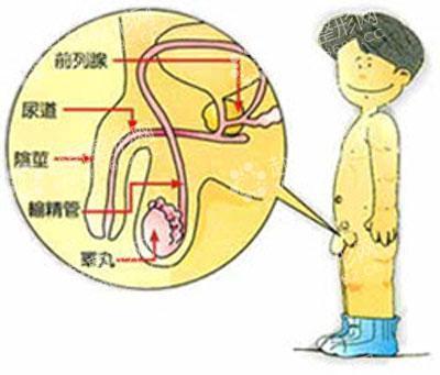 什么可治疗男性隐睾症状