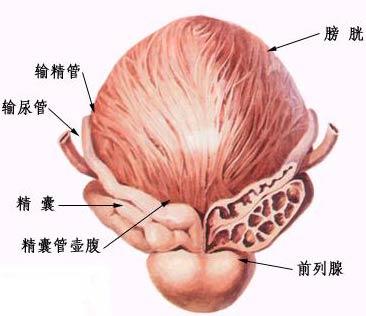 前列腺囊肿究竟是怎么回事