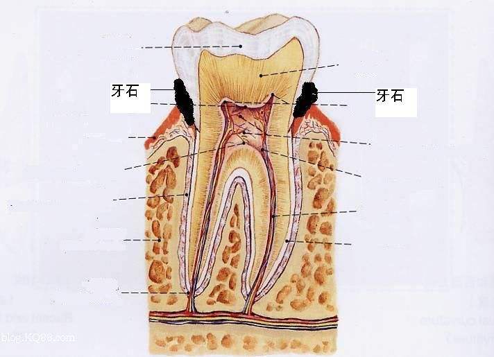  检查  以上即是牙结石需要检查的,也是牙结石的一些具体这症状,希望