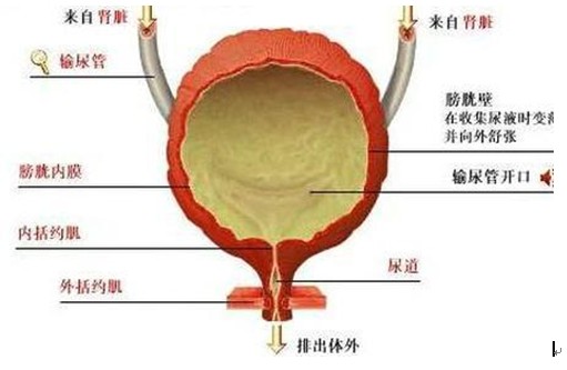 膀胱癌症状