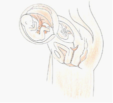 四维彩超记录胎儿是如何发育的