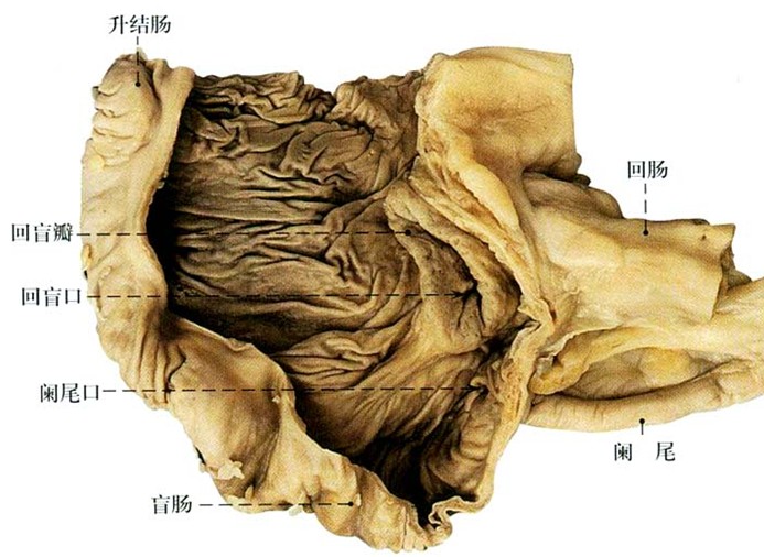 正常盲肠和阑尾解剖图