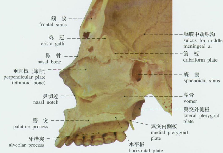 骨鼻中隔呈矢状位,由犁骨和筛骨垂直板构成.