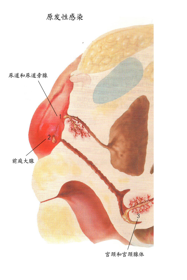 宫颈炎解剖图解