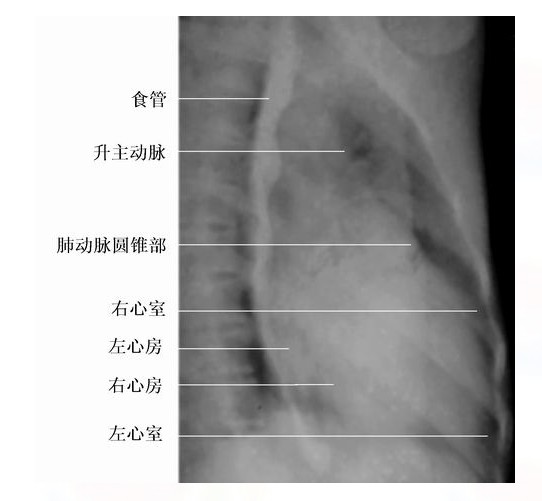 心脏x线医学影像图解