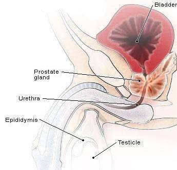 关于前列腺结核吃点什么中成药的问题