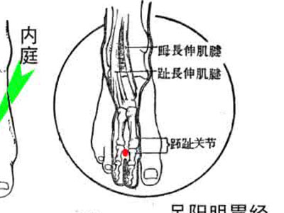 陈退翁与《伤寒针灸穴解》