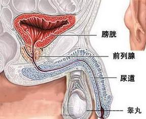 前列腺肉瘤能不治自愈吗