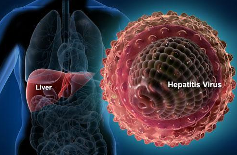 严重急性肝炎的常见症状有哪些
