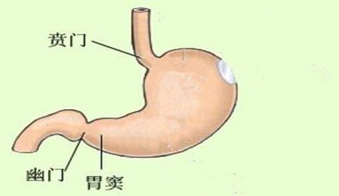 胃窦炎治不好是什么后果