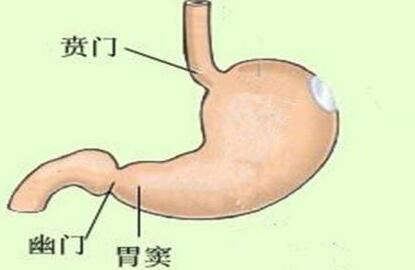 常见的引发胃窦炎的因素