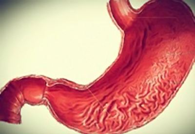 慢性浅表性胃炎患者简介_飞华健康网