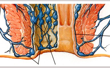 引发内痔的根本原因是什么