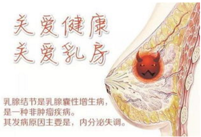 得了乳腺结节还能治愈吗
