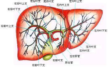 肝内胆管结石的多种诊断方法