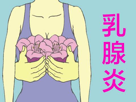 防治乳腺炎不能大意