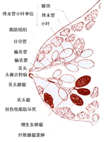 乳腺囊肿病因分类