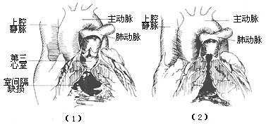 蹲踞时下肢屈曲,使静脉回心血量减少,减轻了心脏负荷,同时下肢动脉