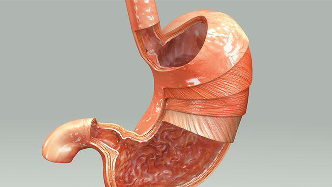 什么是胃间质细胞瘤