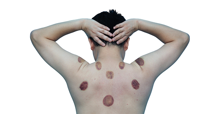 肾虚可以喝酒吗