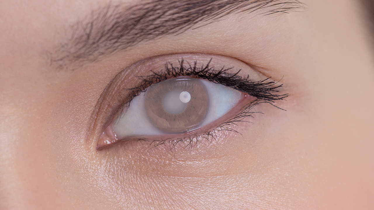 青光眼的常见症状主要有哪些