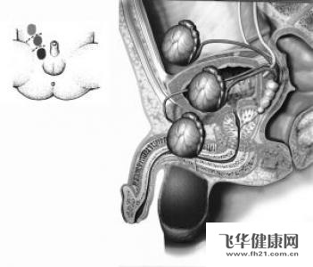 正常的男性嬰兒也好,兒童也好,成年男性也好,正常的都是兩個睪丸的,多