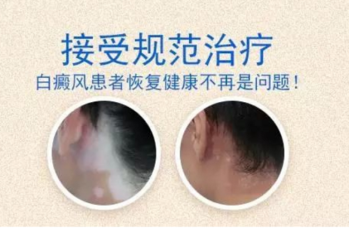 图片_20210804163226.png