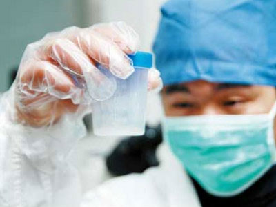 男人精子发黄要引起你足够的重视