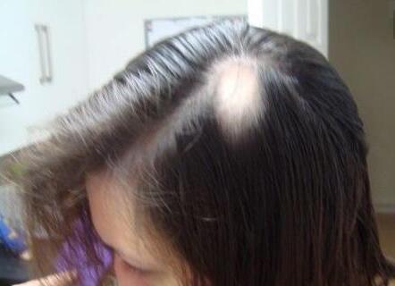 过了多少岁不脱发就不会脱发 ooYBAFfqH0WAebeyAAA-ApBJCXI45.jpeg