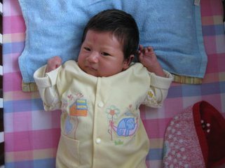 什么是黄疸的症状 ooYBAFf49v6AdZePAAA-aBjw_pw09.jpeg