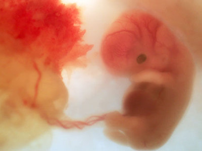 七十天胎儿图片真实图片